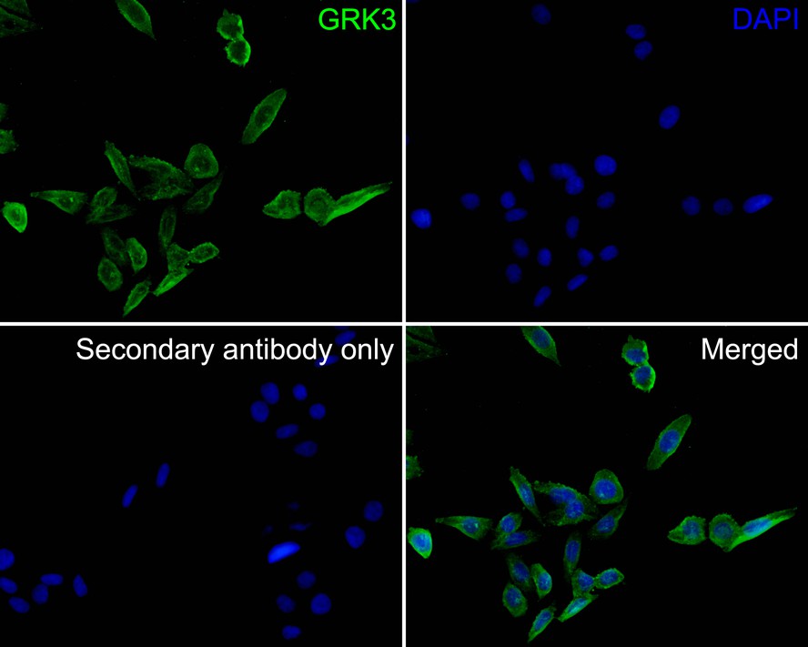 ICC staining of GRK3 in SiHa cells (green). Formalin fixed cells were permeabilized with 0.1% Triton X-100 in TBS for 10 minutes at room temperature and blocked with 10% negative goat serum for 15 minutes at room temperature. Cells were probed with the primary antibody (HA500317, 1/50) for 1 hour at room temperature, washed with PBS. Alexa Fluor®488 conjugate-Goat anti-Rabbit IgG was used as the secondary antibody at 1/1,000 dilution. The nuclear counter stain is DAPI (blue).