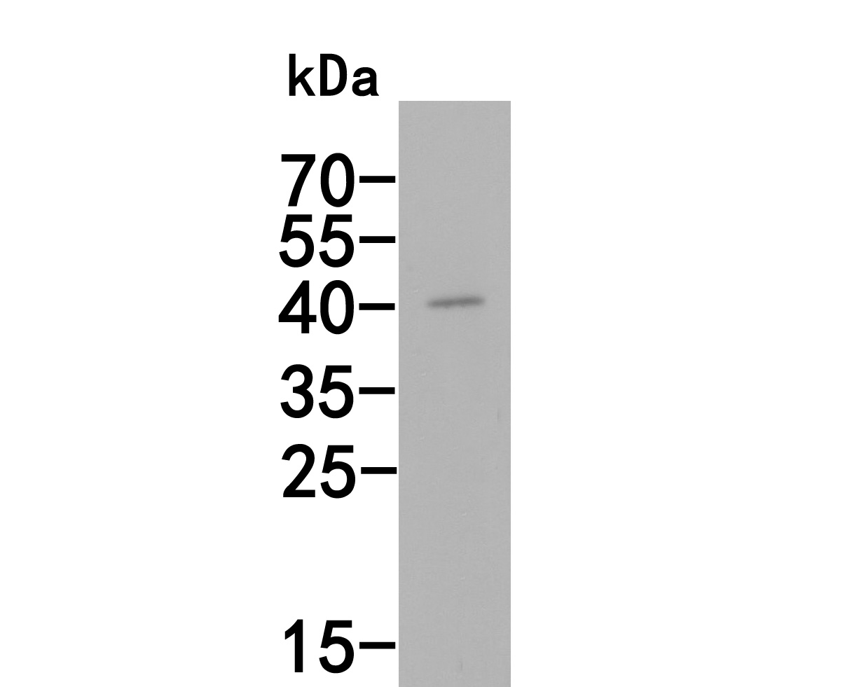 Western blot analysis of AIM2 on Hela cell lysates. Proteins were transferred to a PVDF membrane and blocked with 5% NFDM/TBST for 1 hour at room temperature. The primary antibody (HA500270, 1/500) was used in 5% NFDM/TBST at room temperature for 2 hours. Goat Anti-Rabbit IgG - HRP Secondary Antibody (HA1001) at 1:200,000 dilution was used for 1 hour at room temperature.<br />
<br />
Predicted band size: 39 kDa<br />
Observed band size: 39 kDa