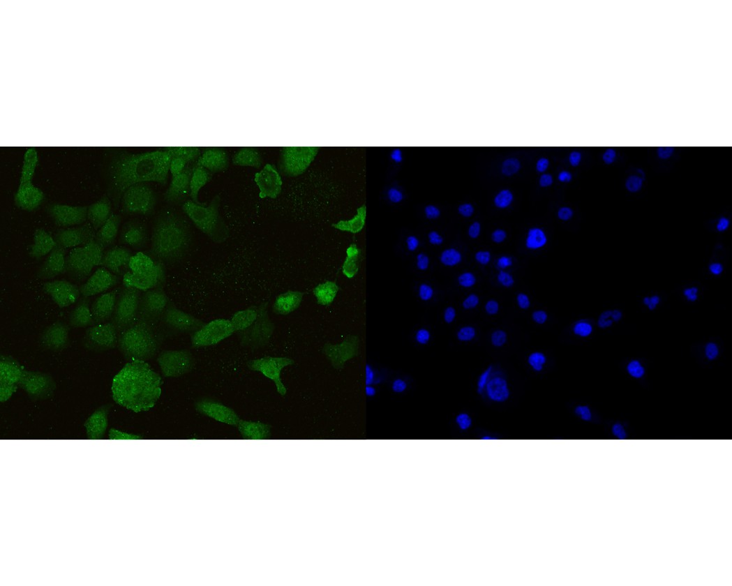 ICC staining of AIM2 in A431 cells (green). Formalin fixed cells were permeabilized with 0.1% Triton X-100 in TBS for 10 minutes at room temperature and blocked with 10% negative goat serum for 15 minutes at room temperature. Cells were probed with the primary antibody (HA500270, 1/50) for 1 hour at room temperature, washed with PBS. Alexa Fluor®488 conjugate-Goat anti-Rabbit IgG was used as the secondary antibody at 1/1,000 dilution. The nuclear counter stain is DAPI (blue).