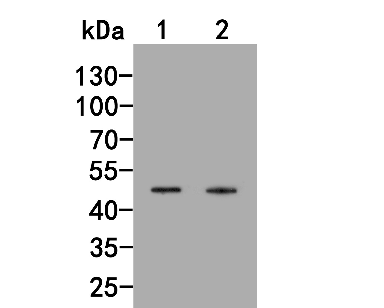 Western blot analysis of Inhibin alpha chain on different lysates. Proteins were transferred to a PVDF membrane and blocked with 5% NFDM/TBST for 1 hour at room temperature. The primary antibody (HA500272, 1/1,000) was used in 5% NFDM/TBST at room temperature for 2 hours. Goat Anti-Rabbit IgG - HRP Secondary Antibody (HA1001) at 1:200,000 dilution was used for 1 hour at room temperature.<br />
Positive control: <br />
Lane 1: K562 cell lysate<br />
Lane 2: Hela cell lysate