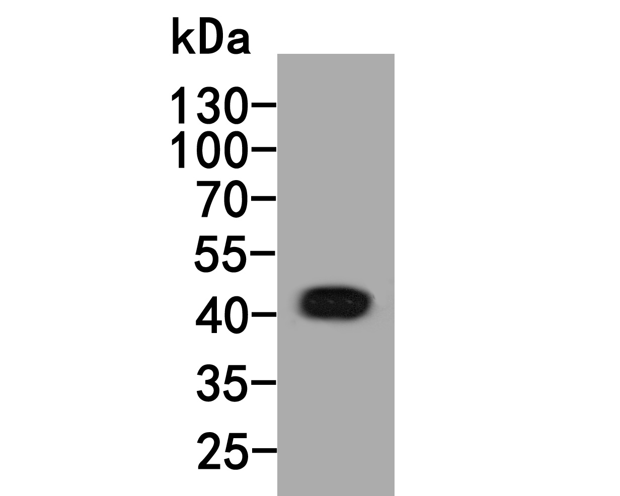 Western blot analysis of Inhibin alpha chain on rat testis tissue lysates. Proteins were transferred to a PVDF membrane and blocked with 5% NFDM/TBST for 1 hour at room temperature. The primary antibody (HA500272, 1/1,000) was used in 5% NFDM/TBST at room temperature for 2 hours. Goat Anti-Rabbit IgG - HRP Secondary Antibody (HA1001) at 1:200,000 dilution was used for 1 hour at room temperature.