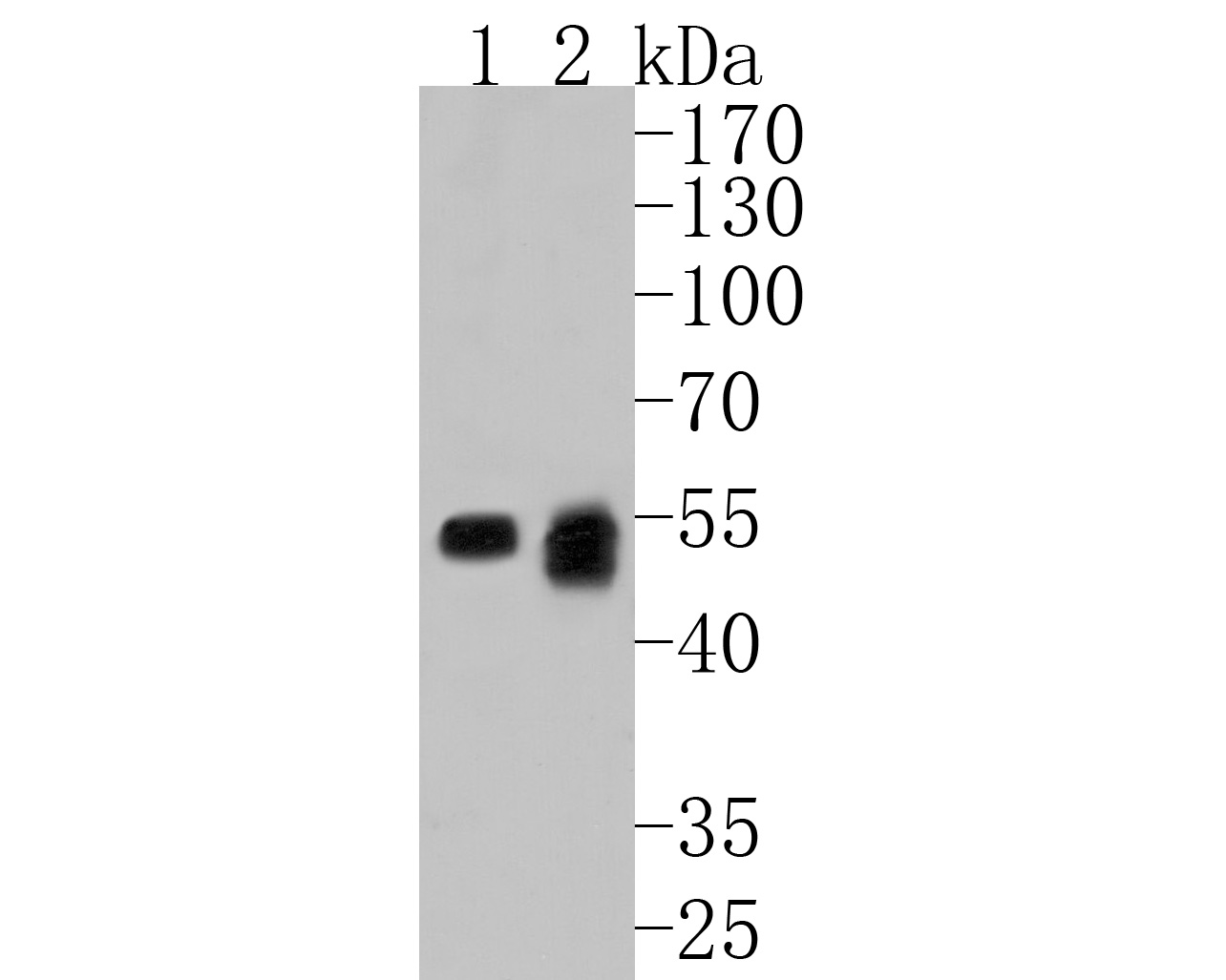 Western blot analysis of Lck on different lysates. Proteins were transferred to a PVDF membrane and blocked with 5% NFDM/TBST for 1 hour at room temperature. The primary antibody (HA500280, 1/1,000) was used in 5% NFDM/TBST at room temperature for 2 hours. Goat Anti-Rabbit IgG - HRP Secondary Antibody (HA1001) at 1:200,000 dilution was used for 1 hour at room temperature.<br />
Positive control: <br />
Lane 1: Rat thymus tissue lysate<br />
Lane 2: Jurkat cell lysate