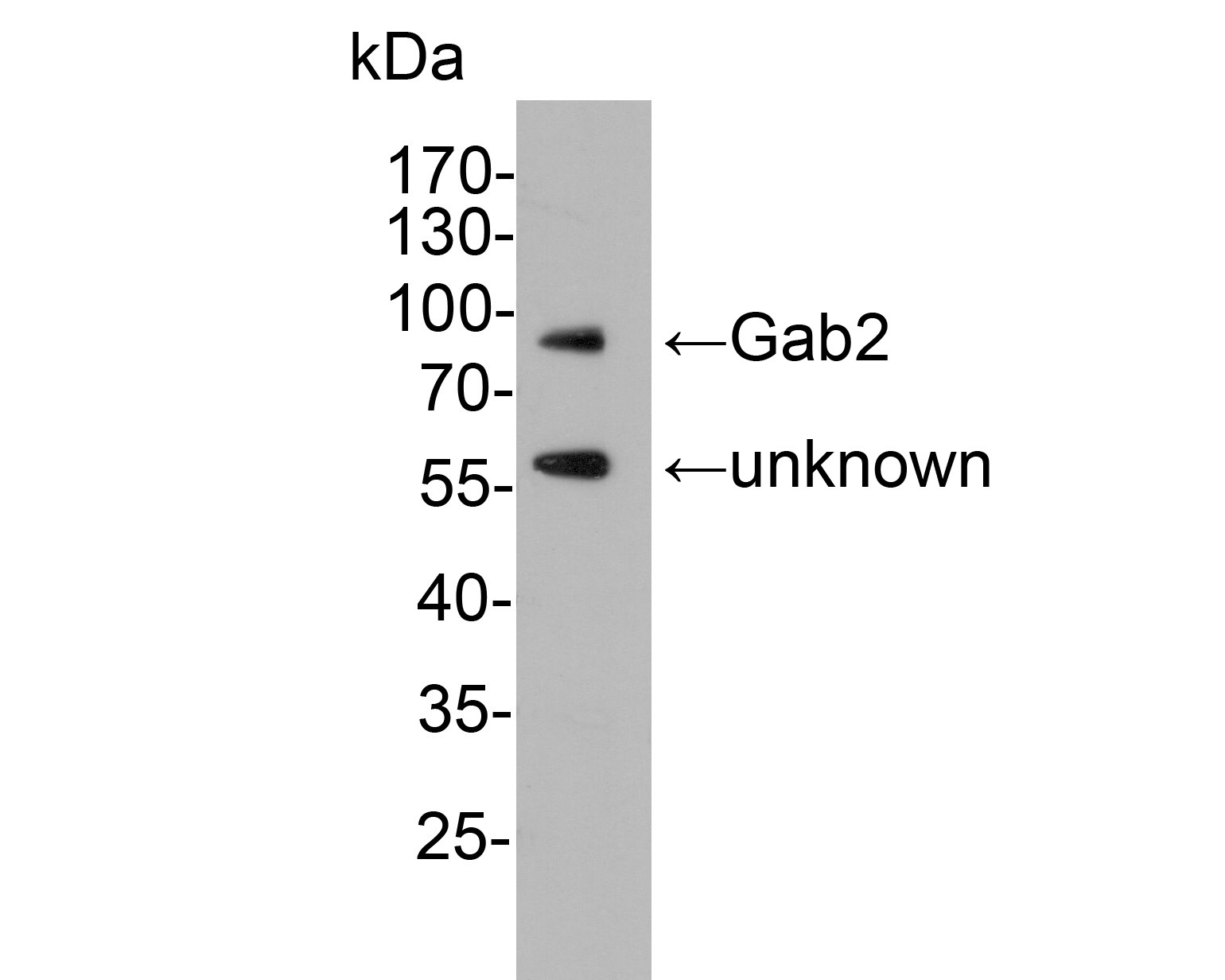 Western blot analysis of Gab2 on rat brain tissue lysate. Proteins were transferred to a PVDF membrane and blocked with 5% NFDM/TBST for 1 hour at room temperature. The primary antibody (HA500292, 1/1,000) was used in 5% NFDM/TBST at room temperature for 2 hours. Goat Anti-Rabbit IgG - HRP Secondary Antibody (HA1001) at 1:200,000 dilution was used for 1 hour at room temperature.