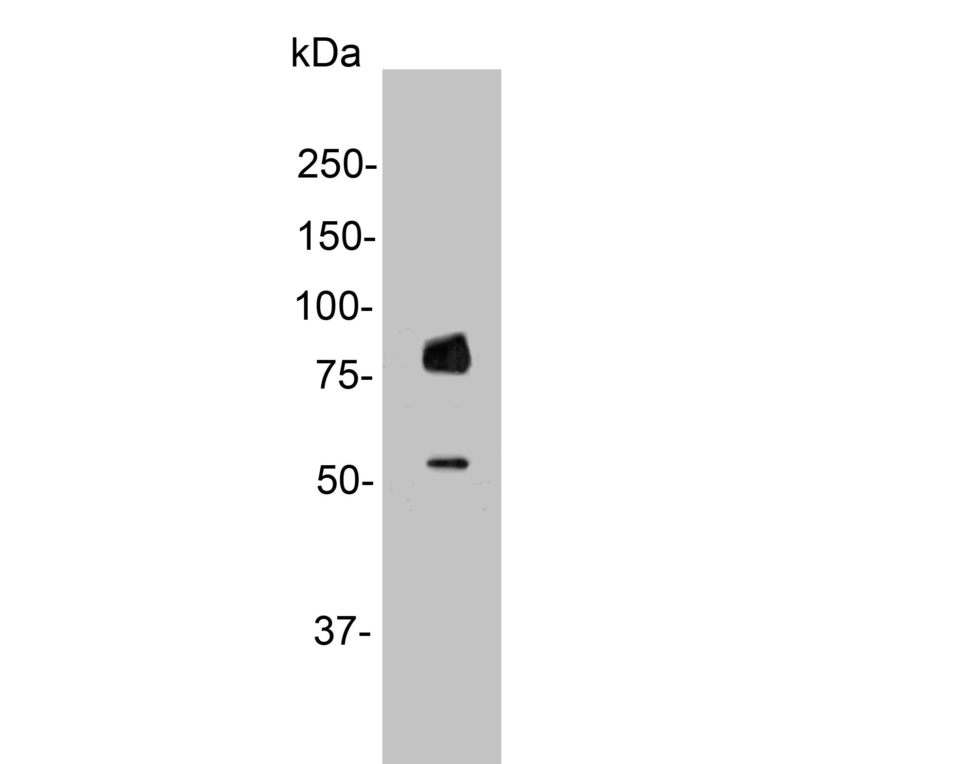 Western blot analysis of Gab2 on SHSY5Y cell lysate. Proteins were transferred to a PVDF membrane and blocked with 5% NFDM/TBST for 1 hour at room temperature. The primary antibody (HA500292, 1/500) was used in 5% NFDM/TBST at room temperature for 2 hours. Goat Anti-Rabbit IgG - HRP Secondary Antibody (HA1001) at 1:200,000 dilution was used for 1 hour at room temperature.
