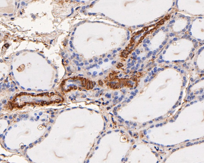 Immunohistochemical analysis of paraffin-embedded human throid gland tissue using anti-Gab2 antibody. The section was pre-treated using heat mediated antigen retrieval with Tris-EDTA buffer (pH 9.0) for 20 minutes.The tissues were blocked in 5% BSA for 30 minutes at room temperature, washed with ddH2O and PBS, and then probed with the primary antibody (HA500292, 1/200) for 30 minutes at room temperature. The detection was performed using an HRP conjugated compact polymer system. DAB was used as the chromogen. Tissues were counterstained with hematoxylin and mounted with DPX.