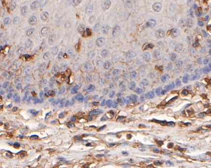 Immunohistochemical analysis of paraffin-embedded human esophagus tissue using anti-Gab2 antibody. The section was pre-treated using heat mediated antigen retrieval with Tris-EDTA buffer (pH 9.0) for 20 minutes.The tissues were blocked in 5% BSA for 30 minutes at room temperature, washed with ddH2O and PBS, and then probed with the primary antibody (HA500292, 1/200) for 30 minutes at room temperature. The detection was performed using an HRP conjugated compact polymer system. DAB was used as the chromogen. Tissues were counterstained with hematoxylin and mounted with DPX.