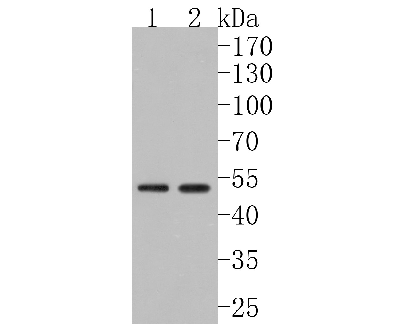 Western blot analysis of FARS2 on different lysates. Proteins were transferred to a PVDF membrane and blocked with 5% NFDM/TBST for 1 hour at room temperature. The primary antibody (HA500261, 1/1,000) was used in 5% NFDM/TBST at room temperature for 2 hours. Goat Anti-Rabbit IgG - HRP Secondary Antibody (HA1001) at 1:200,000 dilution was used for 1 hour at room temperature.<br />
Positive control: <br />
Lane 1: Rat colon tissue lysate<br />
Lane 2: 293T cell lysate<br />
<br />
Predicted band size: 52 kDa<br />
Observed band size: 52 kDa