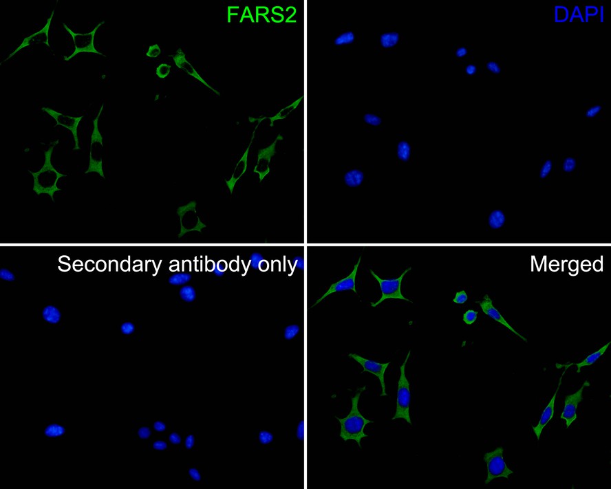 ICC staining of FARS2 in SH-SY5Y cells (green). Formalin fixed cells were permeabilized with 0.1% Triton X-100 in TBS for 10 minutes at room temperature and blocked with 10% negative goat serum for 15 minutes at room temperature. Cells were probed with the primary antibody (HA500261, 1/50) for 1 hour at room temperature, washed with PBS. Alexa Fluor®488 conjugate-Goat anti-Rabbit IgG was used as the secondary antibody at 1/1,000 dilution. The nuclear counter stain is DAPI (blue).