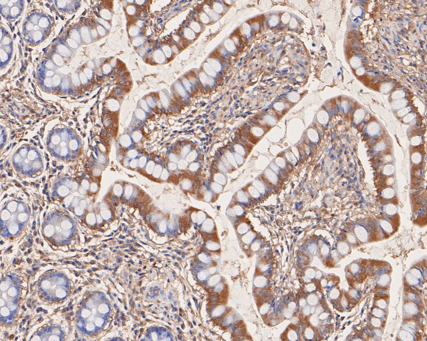 Immunohistochemical analysis of paraffin-embedded human small intestine tissue using anti-FARS2 antibody. The section was pre-treated using heat mediated antigen retrieval with Tris-EDTA buffer (pH 9.0) for 20 minutes.The tissues were blocked in 5% BSA for 30 minutes at room temperature, washed with ddH2O and PBS, and then probed with the primary antibody (HA500261, 1/100) for 30 minutes at room temperature. The detection was performed using an HRP conjugated compact polymer system. DAB was used as the chromogen. Tissues were counterstained with hematoxylin and mounted with DPX.