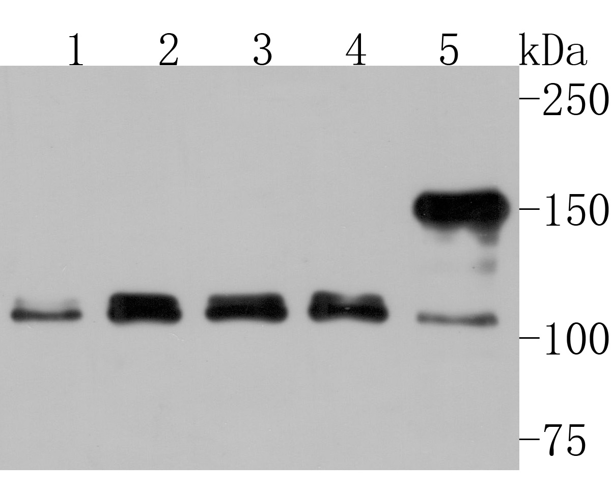 Western blot analysis of p114RhoGEF on different lysates. Proteins were transferred to a PVDF membrane and blocked with 5% NFDM/TBST for 1 hour at room temperature. The primary antibody (HA500310, 1/1,000) was used in 5% NFDM/TBST at room temperature for 2 hours. Goat Anti-Rabbit IgG - HRP Secondary Antibody (HA1001) at 1:200,000 dilution was used for 1 hour at room temperature.<br />
Positive control: <br />
Lane 1: HepG2 cell lysate<br />
Lane 2: Hela cell lysate<br />
Lane 3: 293 cell lysate<br />
Lane 4: PC-3 cell lysate<br />
Lane 5: Daudi cell lysate<br />
<br />
Predicted band size: 152 kDa<br />
Observed band size: 114/152 kDa