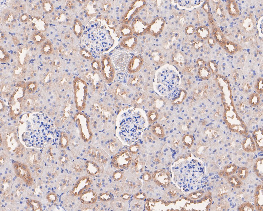 Immunohistochemical analysis of paraffin-embedded rat kidney tissue using anti-p114RhoGEF antibody. The section was pre-treated using heat mediated antigen retrieval with Tris-EDTA buffer (pH 9.0) for 20 minutes.The tissues were blocked in 5% BSA for 30 minutes at room temperature, washed with ddH2O and PBS, and then probed with the primary antibody (HA500310, 1/400) for 30 minutes at room temperature. The detection was performed using an HRP conjugated compact polymer system. DAB was used as the chromogen. Tissues were counterstained with hematoxylin and mounted with DPX.