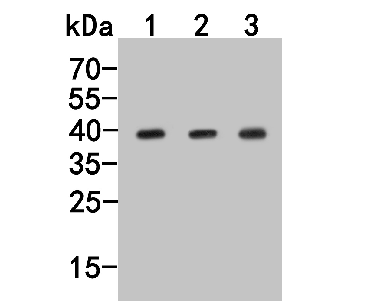 Western blot analysis of GNAI2 on different lysates. Proteins were transferred to a PVDF membrane and blocked with 5% NFDM/TBST for 1 hour at room temperature. The primary antibody (HA500293, 1/1,000) was used in 5% NFDM/TBST at room temperature for 2 hours. Goat Anti-Rabbit IgG - HRP Secondary Antibody (HA1001) at 1:200,000 dilution was used for 1 hour at room temperature.<br />
Positive control: <br />
Lane 1: 293 cell lysate<br />
Lane 2: MCF-7 cell lysate<br />
Lane 3: Mouse hippocampus tissue lysate