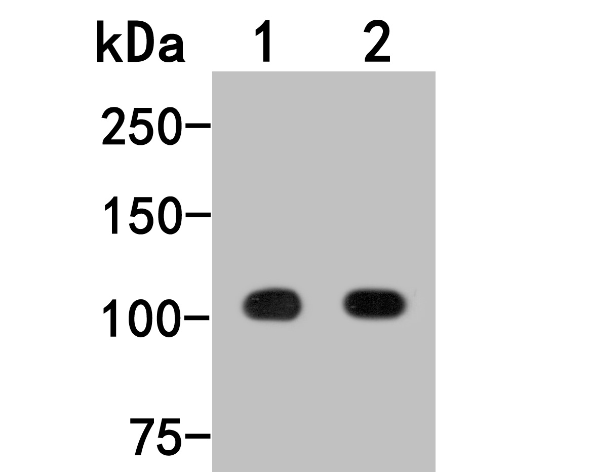 Western blot analysis of AP2B1 on different lysates. Proteins were transferred to a PVDF membrane and blocked with 5% NFDM/TBST for 1 hour at room temperature. The primary antibody (HA500315, 1/1,000) was used in 5% NFDM/TBST at room temperature for 2 hours. Goat Anti-Rabbit IgG - HRP Secondary Antibody (HA1001) at 1:200,000 dilution was used for 1 hour at room temperature.<br />
Positive control: <br />
Lane 1: Mouse brain tissue lysate<br />
Lane 2: Rat brain tissue lysate