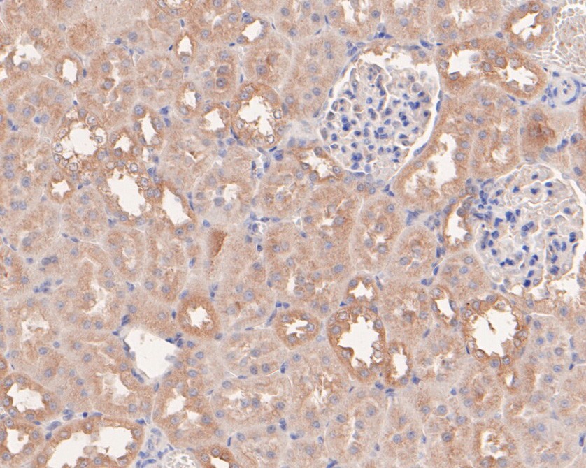 Immunohistochemical analysis of paraffin-embedded human liver tissue using anti-AP2B1 antibody. The section was pre-treated using heat mediated antigen retrieval with Tris-EDTA buffer (pH 9.0) for 20 minutes.The tissues were blocked in 5% BSA for 30 minutes at room temperature, washed with ddH2O and PBS, and then probed with the primary antibody (HA500315, 1/100) for 30 minutes at room temperature. The detection was performed using an HRP conjugated compact polymer system. DAB was used as the chromogen. Tissues were counterstained with hematoxylin and mounted with DPX.