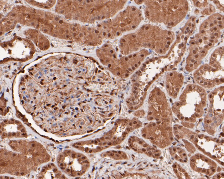 Immunohistochemical analysis of paraffin-embedded human kidney tissue using anti-TAZ antibody. The section was pre-treated using heat mediated antigen retrieval with sodium citrate buffer (pH 6.0) for 20 minutes. The tissues were blocked in 5% BSA for 30 minutes at room temperature, washed with ddH2O and PBS, and then probed with the primary antibody (HA500300, 1/400)  for 30 minutes at room temperature. The detection was performed using an HRP conjugated compact polymer system. DAB was used as the chromogen. Tissues were counterstained with hematoxylin and mounted with DPX.
