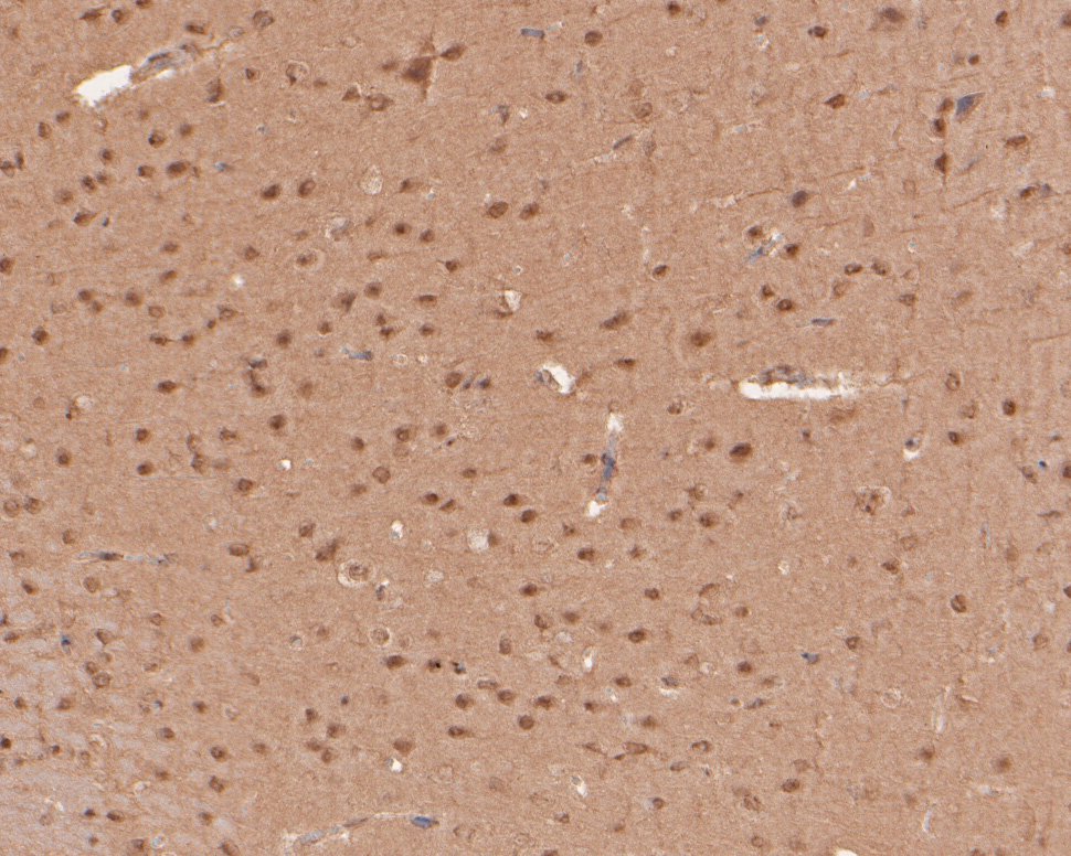 Immunohistochemical analysis of paraffin-embedded mouse brain tissue using anti-TAZ antibody. The section was pre-treated using heat mediated antigen retrieval with sodium citrate buffer (pH 6.0) for 20 minutes. The tissues were blocked in 5% BSA for 30 minutes at room temperature, washed with ddH2O and PBS, and then probed with the primary antibody (HA500300, 1/100)  for 30 minutes at room temperature. The detection was performed using an HRP conjugated compact polymer system. DAB was used as the chromogen. Tissues were counterstained with hematoxylin and mounted with DPX.