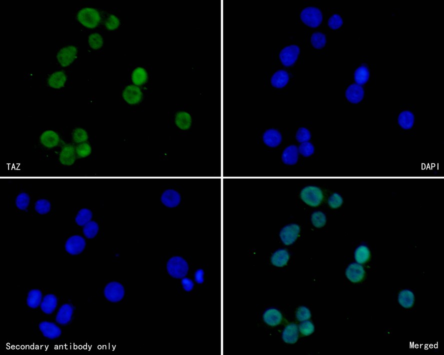 ICC staining of TAZ in HT-29 cells (green). Formalin fixed cells were permeabilized with 0.1% Triton X-100 in TBS for 10 minutes at room temperature and blocked with 10% negative goat serum for 15 minutes at room temperature. Cells were probed with the primary antibody (HA500300, 1/200) for 1 hour at room temperature, washed with PBS. Alexa Fluor®488 conjugate-Goat anti-Rabbit IgG was used as the secondary antibody at 1/1,000 dilution. The nuclear counter stain is DAPI (blue).