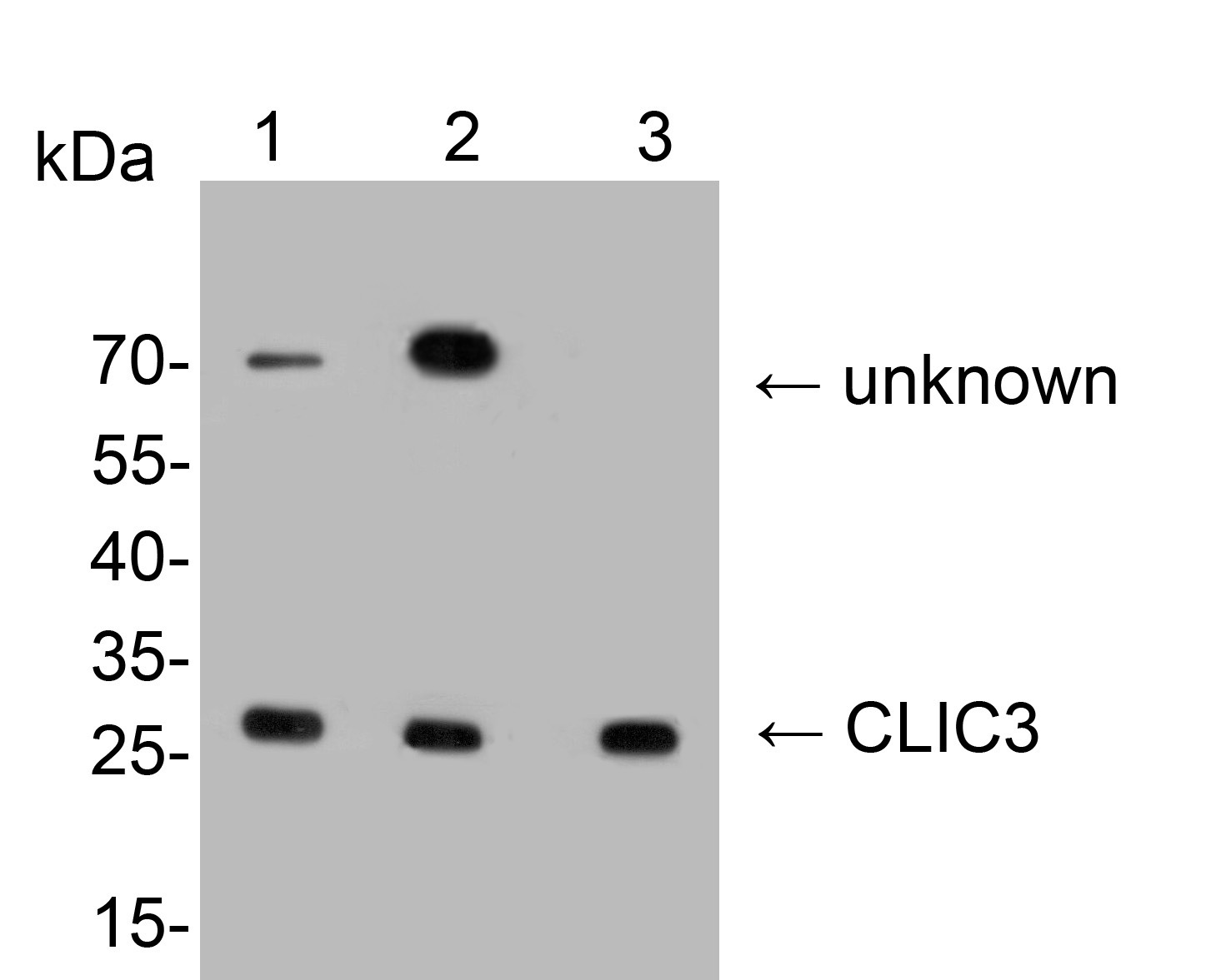 Western blot analysis of CLIC3 on different lysates. Proteins were transferred to a PVDF membrane and blocked with 5% NFDM/TBST for 1 hour at room temperature. The primary antibody (HA500316, 1/500) was used in 5% NFDM/TBST at room temperature for 2 hours. Goat Anti-Rabbit IgG - HRP Secondary Antibody (HA1001) at 1:200,000 dilution was used for 1 hour at room temperature.<br />
Positive control: <br />
Lane 1: Human placenta tissue lysate<br />
Lane 2: Mouse lung tissue lysate<br />
Lane 3: Human lung tissue lysate