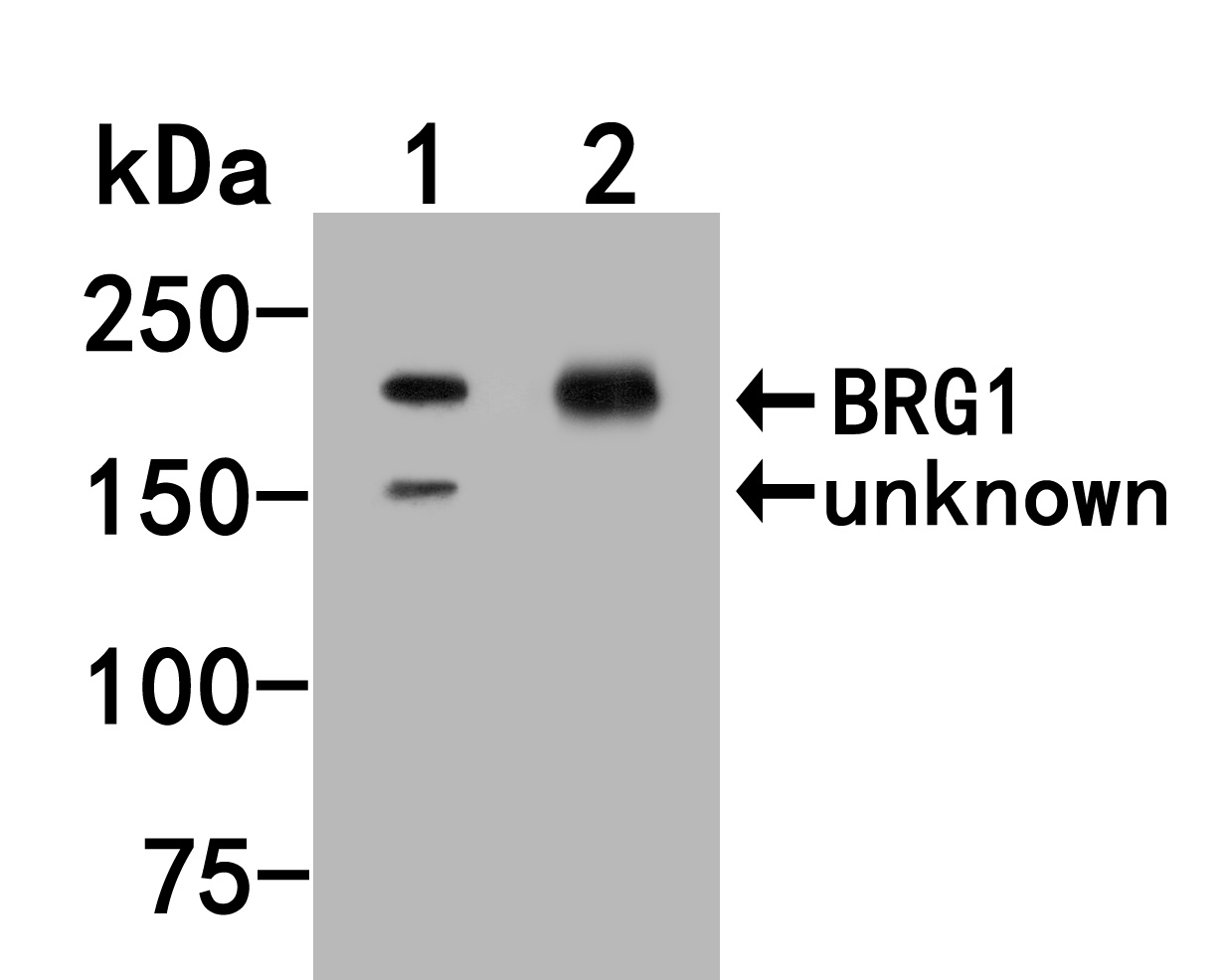 Western blot analysis of BRG1 on different lysates. Proteins were transferred to a PVDF membrane and blocked with 5% NFDM/TBST for 1 hour at room temperature. The primary antibody (HA500262, 1/1,000) was used in 5% NFDM/TBST at room temperature for 2 hours. Goat Anti-Rabbit IgG - HRP Secondary Antibody (HA1001) at 1:200,000 dilution was used for 1 hour at room temperature.<br />
Positive control: <br />
Lane 1: 293 cell lysate<br />
Lane 2: Daudi cell lysate