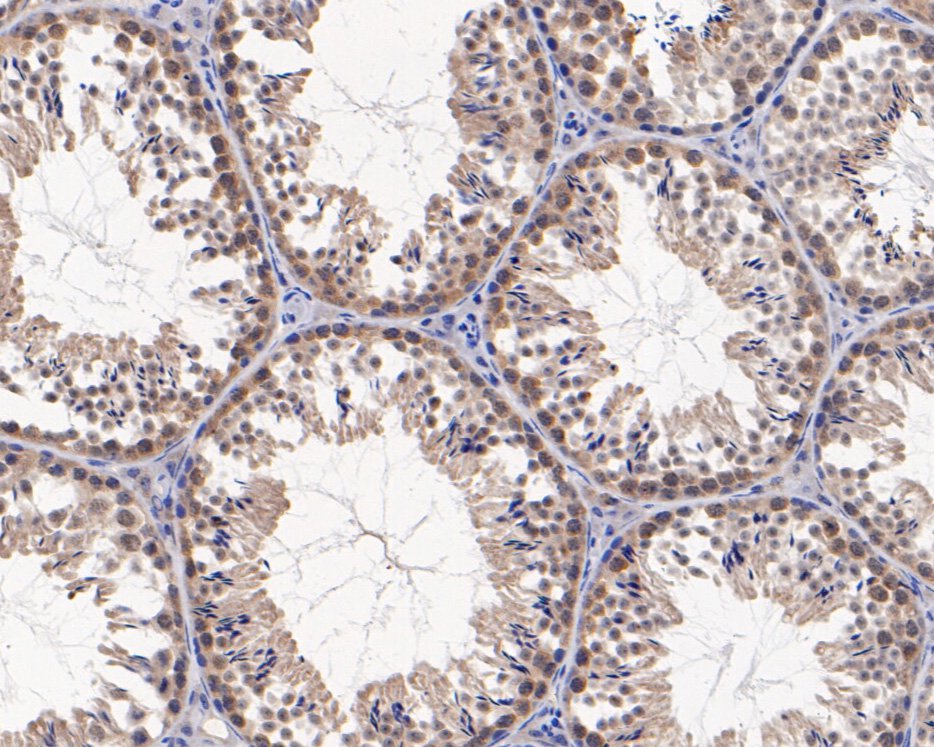 Immunohistochemical analysis of paraffin-embedded mouse testis tissue using anti-BRG1 antibody. The section was pre-treated using heat mediated antigen retrieval with sodium citrate buffer (pH 6.0) for 20 minutes. The tissues were blocked in 5% BSA for 30 minutes at room temperature, washed with ddH2O and PBS, and then probed with the primary antibody (HA500262, 1/200)  for 30 minutes at room temperature. The detection was performed using an HRP conjugated compact polymer system. DAB was used as the chromogen. Tissues were counterstained with hematoxylin and mounted with DPX.