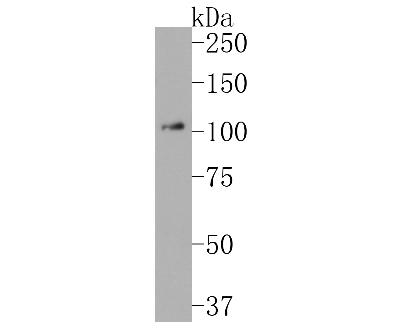 Western blot analysis of DDX58 on HUVEC cell lysates. Proteins were transferred to a PVDF membrane and blocked with 5% NFDM/TBST for 1 hour at room temperature. The primary antibody (HA720090, 1/500) was used in 5% NFDM/TBST at room temperature for 2 hours. Goat Anti-Rabbit IgG - HRP Secondary Antibody (HA1001) at 1:200,000 dilution was used for 1 hour at room temperature.