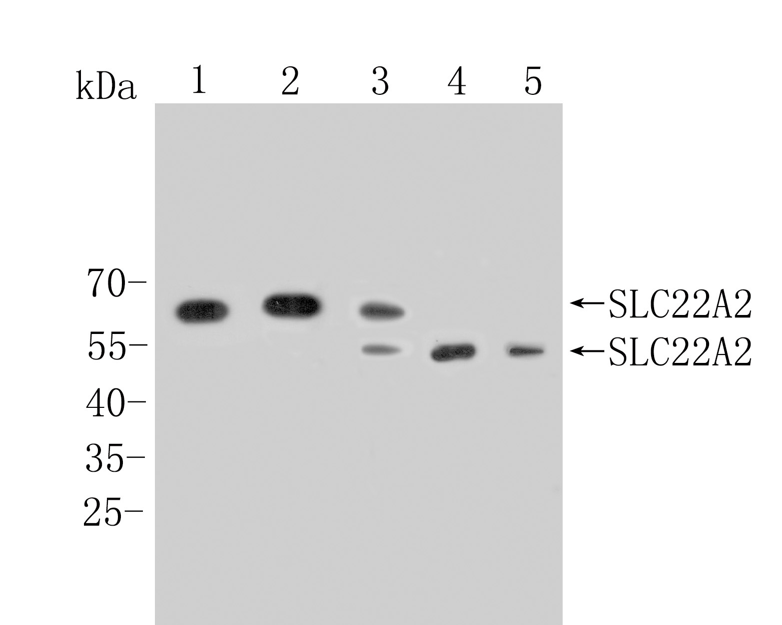 Western blot analysis of SLC22A2 on different lysates. Proteins were transferred to a PVDF membrane and blocked with 5% NFDM/TBST for 1 hour at room temperature. The primary antibody (HA500306, 1/1,000) was used in 5% NFDM/TBST at room temperature for 2 hours. Goat Anti-Rabbit IgG - HRP Secondary Antibody (HA1001) at 1:200,000 dilution was used for 1 hour at room temperature.<br />
Positive control: <br />
Lane 1: HepG2 cell lysate<br />
Lane 2: 293T cell lysate<br />
Lane 3: Rat brain tissue lysate<br />
Lane 4: Mouse kidney tissue lysate<br />
Lane 5: Mouse brain tissue lysate