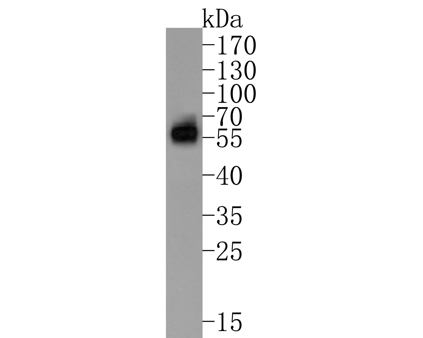 Western blot analysis of  on MDA-MB-468 cell lysates. Proteins were transferred to a PVDF membrane and blocked with 5% NFDM/TBST for 1 hour at room temperature. The primary antibody (HA600073, 1/500) was used in 5% NFDM/TBST at room temperature for 2 hours. Goat Anti-Mouse IgG - HRP Secondary Antibody (HA1006) at 1:20,000 dilution was used for 1 hour at room temperature.<br />
<br />
Predicted band size: 36 kDa<br />
Observed band size: 55 kDa