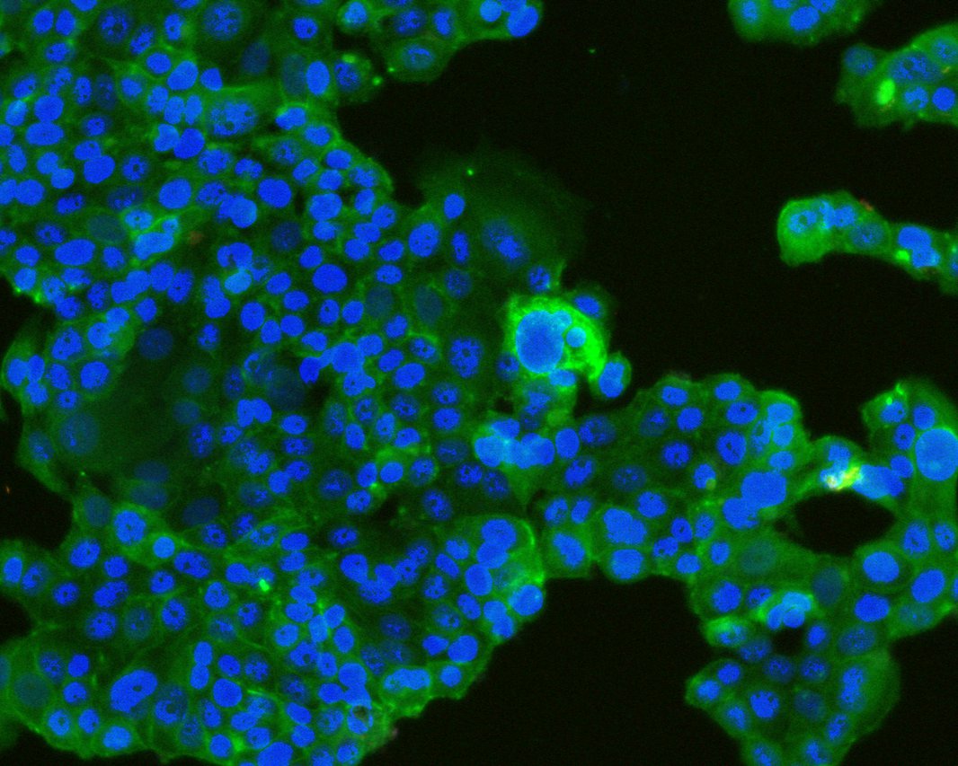 ICC staining of TROP2 in MCF-7 cells (green). Formalin fixed cells were permeabilized with 0.1% Triton X-100 in TBS for 10 minutes at room temperature and blocked with 10% negative goat serum for 15 minutes at room temperature. Cells were probed with the primary antibody (HA600073, 1/50) for 1 hour at room temperature, washed with PBS. Alexa Fluor®488 conjugate-Goat anti-Mouse IgG was used as the secondary antibody at 1/1,000 dilution. The nuclear counter stain is DAPI (blue).