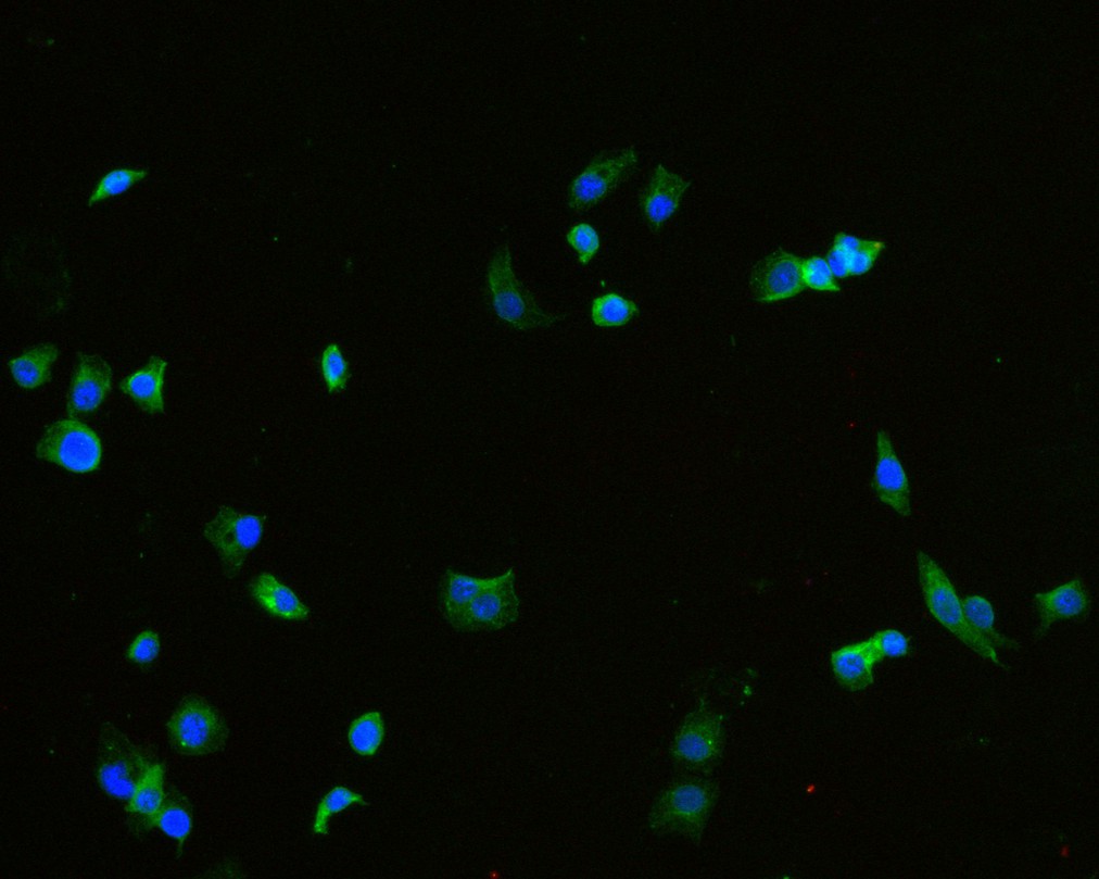 ICC staining of  in MDA-MB-468 cells (green). Formalin fixed cells were permeabilized with 0.1% Triton X-100 in TBS for 10 minutes at room temperature and blocked with 10% negative goat serum for 15 minutes at room temperature. Cells were probed with the primary antibody (HA600073, 1/50) for 1 hour at room temperature, washed with PBS. Alexa Fluor®488 conjugate-Goat anti-Mouse IgG was used as the secondary antibody at 1/1,000 dilution. The nuclear counter stain is DAPI (blue).