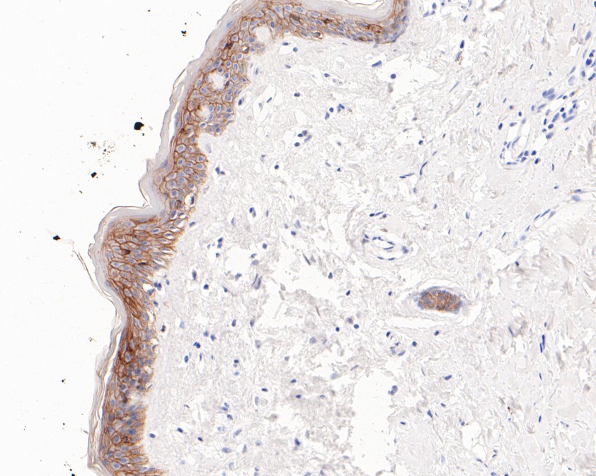 Immunohistochemical analysis of paraffin-embedded human skin tissue using anti-TROP2 antibody. The section was pre-treated using heat mediated antigen retrieval with sodium citrate buffer (pH 6.0) for 20 minutes. The tissues were blocked in 1% BSA for 30 minutes at room temperature, washed with ddH2O and PBS, and then probed with the primary antibody (HA600073, 1/400)  for 30 minutes at room temperature. The detection was performed using an HRP conjugated compact polymer system. DAB was used as the chromogen. Tissues were counterstained with hematoxylin and mounted with DPX.