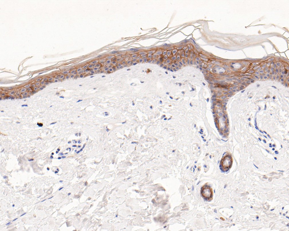 Immunohistochemical analysis of paraffin-embedded human skin tissue using anti-TROP2 antibody. The section was pre-treated using heat mediated antigen retrieval with sodium citrate buffer (pH 6.0) for 20 minutes. The tissues were blocked in 1% BSA for 30 minutes at room temperature, washed with ddH2O and PBS, and then probed with the primary antibody (HA600069, 1/400)  for 30 minutes at room temperature. The detection was performed using an HRP conjugated compact polymer system. DAB was used as the chromogen. Tissues were counterstained with hematoxylin and mounted with DPX.