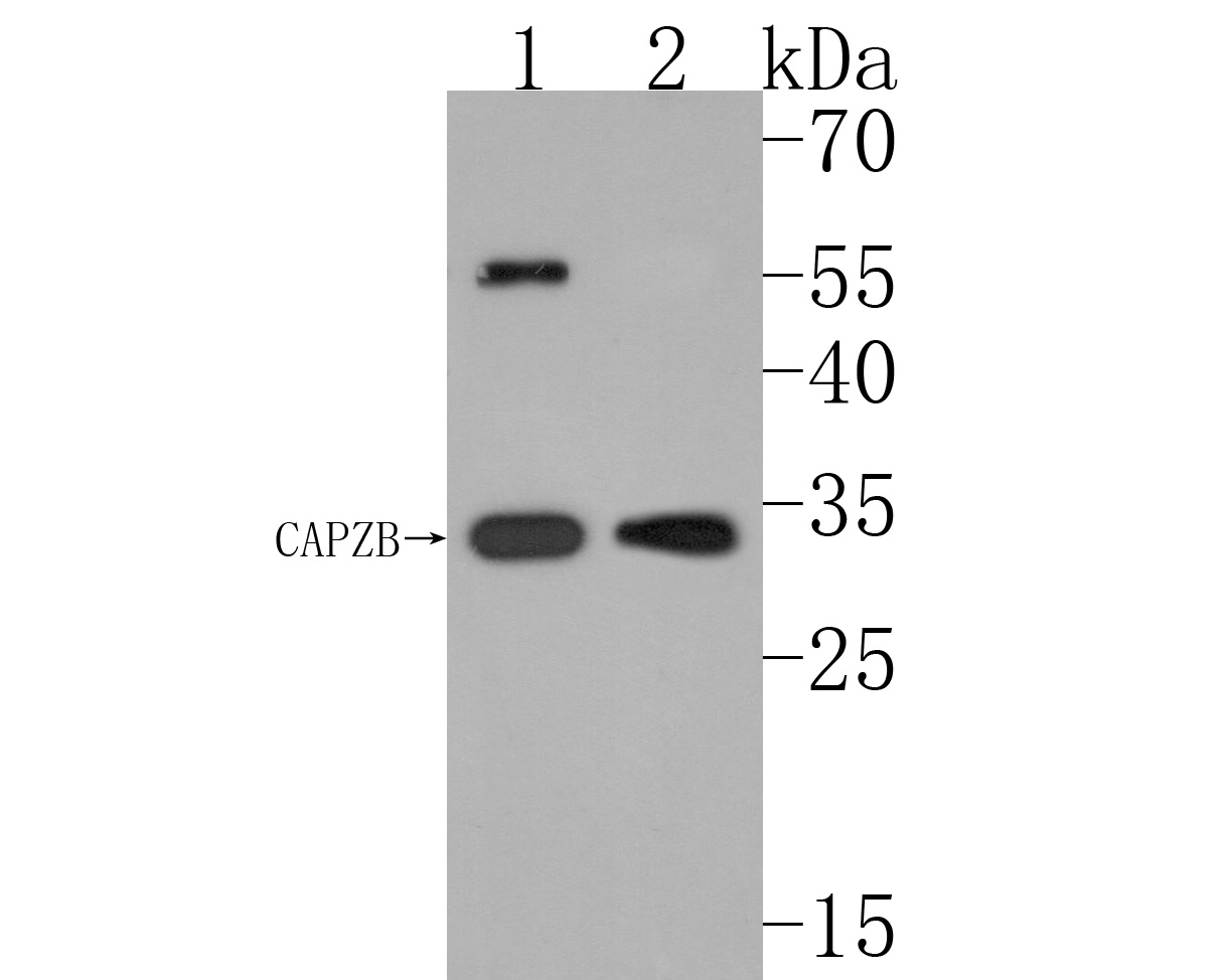 Western blot analysis of CAPZB on different lysates. Proteins were transferred to a PVDF membrane and blocked with 5% NFDM/TBST for 1 hour at room temperature. The primary antibody (HA500486, 1/1,000) was used in 5% NFDM/TBST at room temperature for 2 hours. Goat Anti-Rabbit IgG - HRP Secondary Antibody (HA1001) at 1:200,000 dilution was used for 1 hour at room temperature.<br />
Positive control: <br />
Lane 1: Mouse brain tissue lysate<br />
Lane 2: Mouse testis tissue lysate