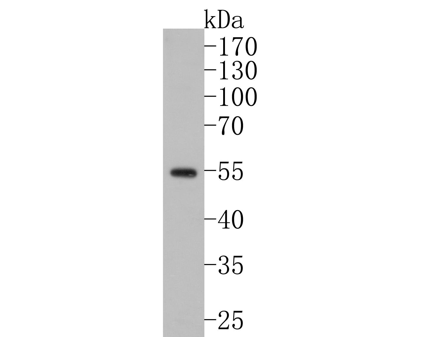 Western blot analysis of GABA A Receptor alpha 6 on rat testis tissue lysates. Proteins were transferred to a PVDF membrane and blocked with 5% NFDM/TBST for 1 hour at room temperature. The primary antibody (HA500473, 1/2,000) was used in 5% NFDM/TBST at room temperature for 2 hours. Goat Anti-Rabbit IgG - HRP Secondary Antibody (HA1001) at 1:200,000 dilution was used for 1 hour at room temperature.