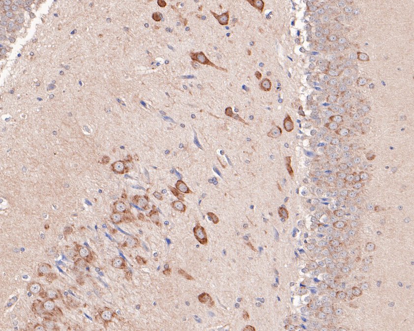 Immunohistochemical analysis of paraffin-embedded rat brain tissue using anti-GABA A Receptor alpha 6 antibody. The section was pre-treated using heat mediated antigen retrieval with Tris-EDTA buffer (pH 9.0) for 20 minutes.The tissues were blocked in 1% BSA for 30 minutes at room temperature, washed with ddH2O and PBS, and then probed with the primary antibody (HA500473, 1/400) for 30 minutes at room temperature. The detection was performed using an HRP conjugated compact polymer system. DAB was used as the chromogen. Tissues were counterstained with hematoxylin and mounted with DPX.