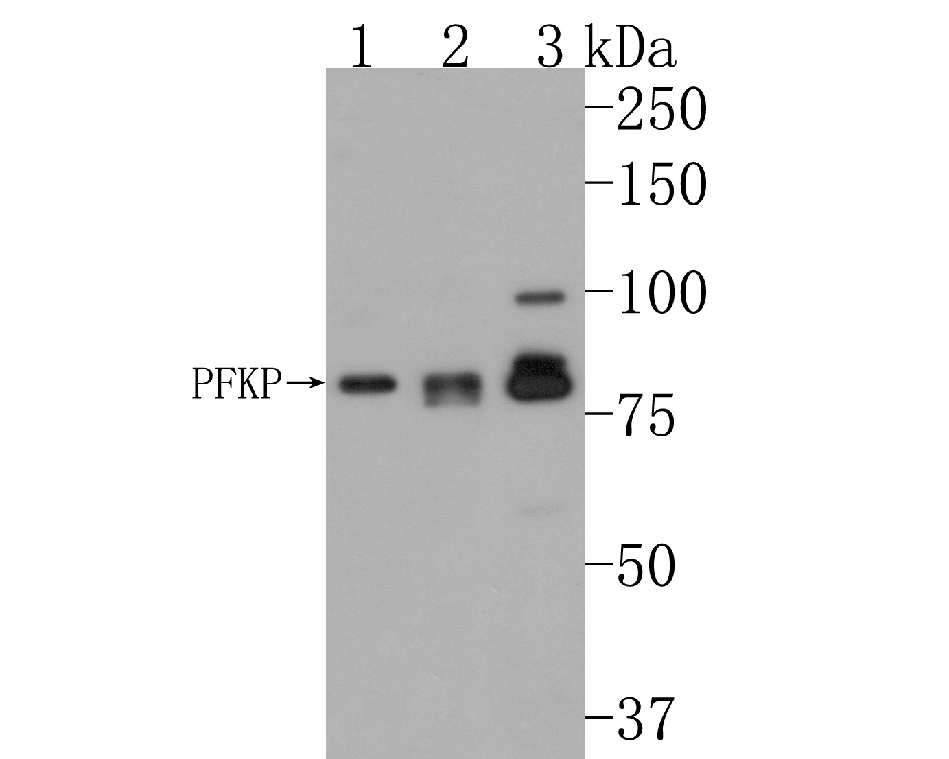 PFKP Rabbit Polyclonal Antibody - image 1