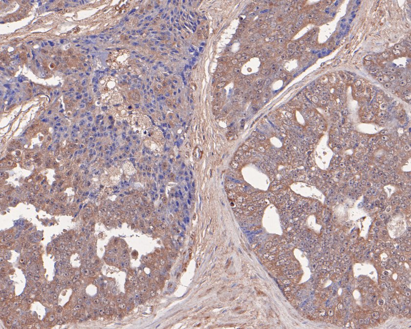 PFKP Rabbit Polyclonal Antibody - image 2