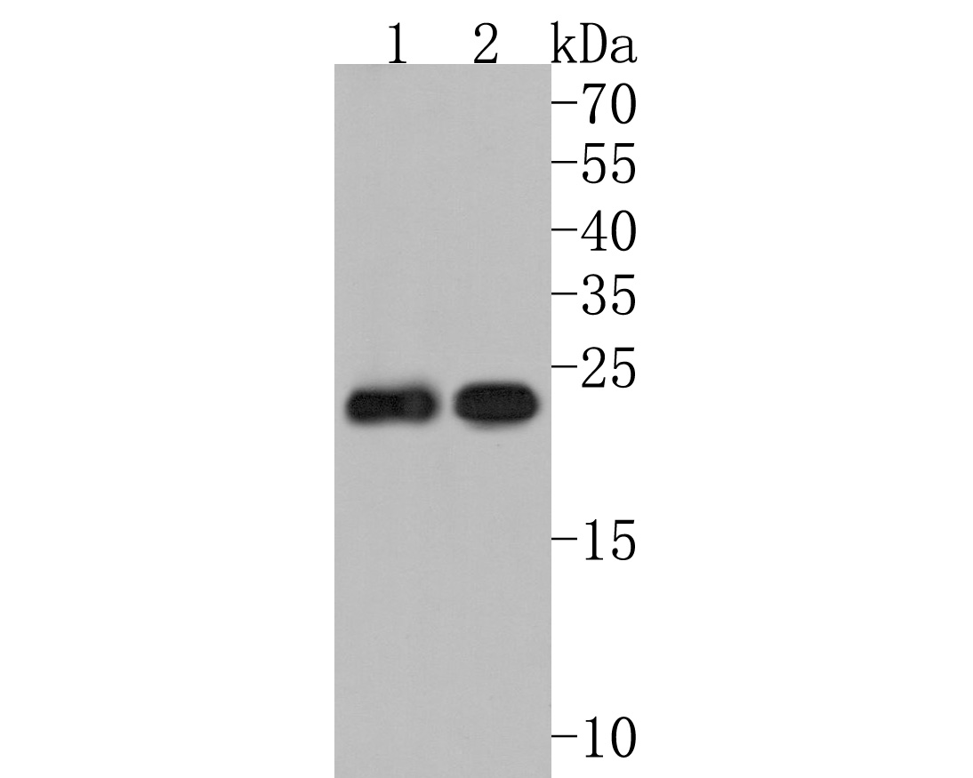 Western blot analysis of MYL4 on different lysates. Proteins were transferred to a PVDF membrane and blocked with 5% NFDM/TBST for 1 hour at room temperature. The primary antibody (HA500471, 1/500) was used in 5% NFDM/TBST at room temperature for 2 hours. Goat Anti-Rabbit IgG - HRP Secondary Antibody (HA1001) at 1:200,000 dilution was used for 1 hour at room temperature.<br />
Positive control: <br />
Lane 1: Mouse lung tissue lysate<br />
Lane 2: Human heart tissue lysate
