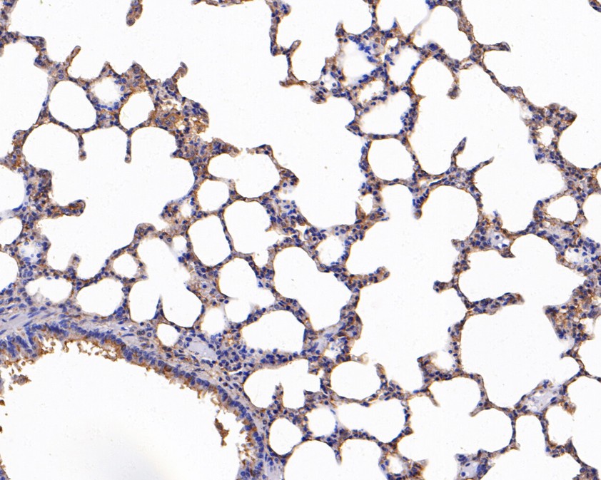 Immunohistochemical analysis of paraffin-embedded rat lung tissue using anti-MYL4 antibody. The section was pre-treated using heat mediated antigen retrieval with Tris-EDTA buffer (pH 9.0) for 20 minutes.The tissues were blocked in 1% BSA for 30 minutes at room temperature, washed with ddH2O and PBS, and then probed with the primary antibody (HA500471, 1/800) for 30 minutes at room temperature. The detection was performed using an HRP conjugated compact polymer system. DAB was used as the chromogen. Tissues were counterstained with hematoxylin and mounted with DPX.