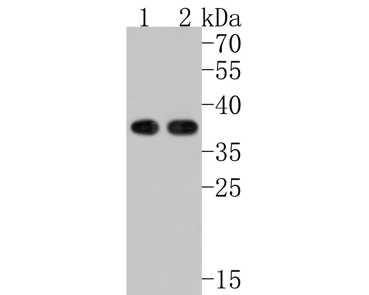 Western blot analysis of PHF11 on different lysates. Proteins were transferred to a PVDF membrane and blocked with 5% NFDM/TBST for 1 hour at room temperature. The primary antibody (HA500478, 1/5,000) was used in 5% NFDM/TBST at room temperature for 2 hours. Goat Anti-Rabbit IgG - HRP Secondary Antibody (HA1001) at 1:200,000 dilution was used for 1 hour at room temperature.<br />
Positive control: <br />
Lane 1: Raji cell lysate<br />
Lane 2: Jurkat cell lysate