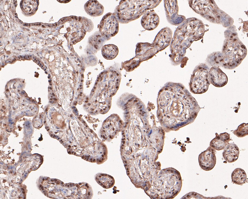 Immunohistochemical analysis of paraffin-embedded human placenta tissue using anti-PHF11 antibody. The section was pre-treated using heat mediated antigen retrieval with sodium citrate buffer (pH 6.0) for 20 minutes. The tissues were blocked in 1% BSA for 30 minutes at room temperature, washed with ddH2O and PBS, and then probed with the primary antibody (HA500478, 1/400)  for 30 minutes at room temperature. The detection was performed using an HRP conjugated compact polymer system. DAB was used as the chromogen. Tissues were counterstained with hematoxylin and mounted with DPX.