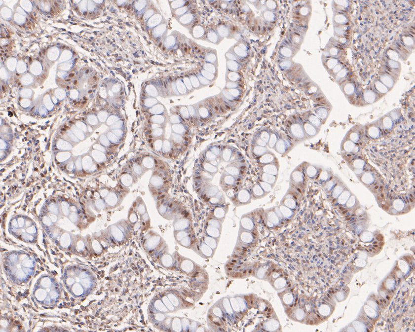 Immunohistochemical analysis of paraffin-embedded human small intestine tissue using anti-PHF11 antibody. The section was pre-treated using heat mediated antigen retrieval with sodium citrate buffer (pH 6.0) for 20 minutes. The tissues were blocked in 1% BSA for 30 minutes at room temperature, washed with ddH2O and PBS, and then probed with the primary antibody (HA500478, 1/400)  for 30 minutes at room temperature. The detection was performed using an HRP conjugated compact polymer system. DAB was used as the chromogen. Tissues were counterstained with hematoxylin and mounted with DPX.