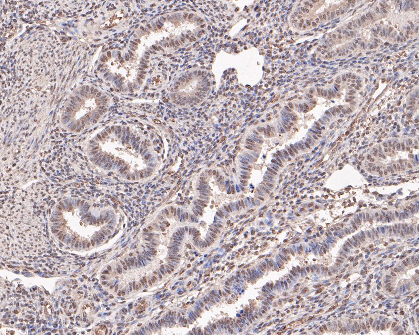 Immunohistochemical analysis of paraffin-embedded human uterus tissue using anti-PHF11 antibody. The section was pre-treated using heat mediated antigen retrieval with sodium citrate buffer (pH 6.0) for 20 minutes. The tissues were blocked in 1% BSA for 30 minutes at room temperature, washed with ddH2O and PBS, and then probed with the primary antibody (HA500478, 1/400)  for 30 minutes at room temperature. The detection was performed using an HRP conjugated compact polymer system. DAB was used as the chromogen. Tissues were counterstained with hematoxylin and mounted with DPX.