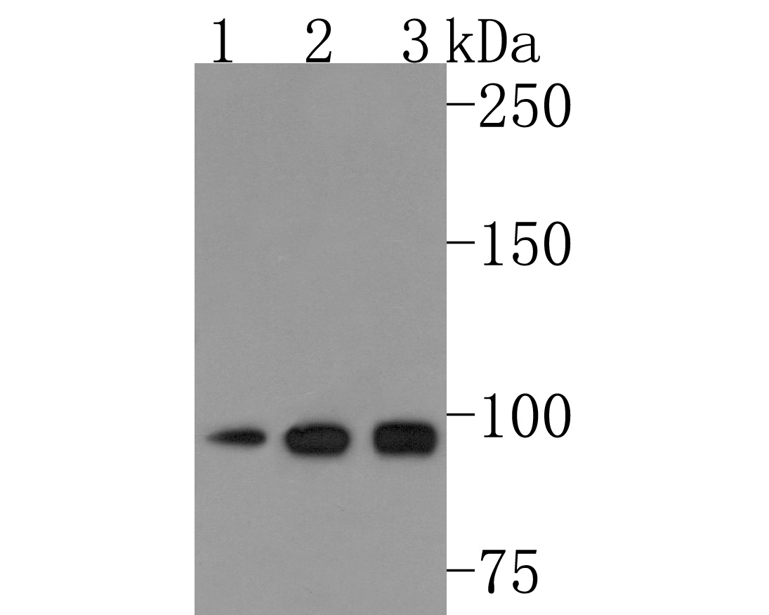 Western blot analysis of AP2A2 on different lysates. Proteins were transferred to a PVDF membrane and blocked with 5% NFDM/TBST for 1 hour at room temperature. The primary antibody (HA500477, 1/2,000) was used in 5% NFDM/TBST at room temperature for 2 hours. Goat Anti-Rabbit IgG - HRP Secondary Antibody (HA1001) at 1:200,000 dilution was used for 1 hour at room temperature.<br />
Positive control: <br />
Lane 2: Hela cell lysate<br />
Lane 1: Mouse cerebellum tissue lysate<br />
Lane 1: Rat brain tissue lysate