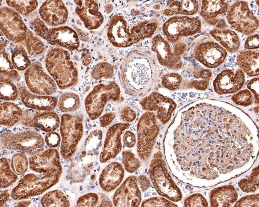 Immunohistochemical analysis of paraffin-embedded human kidney tissue using anti-AP2A2 antibody. The section was pre-treated using heat mediated antigen retrieval with Tris-EDTA buffer (pH 9.0) for 20 minutes.The tissues were blocked in 1% BSA for 30 minutes at room temperature, washed with ddH2O and PBS, and then probed with the primary antibody (HA500477, 1/600) for 30 minutes at room temperature. The detection was performed using an HRP conjugated compact polymer system. DAB was used as the chromogen. Tissues were counterstained with hematoxylin and mounted with DPX.