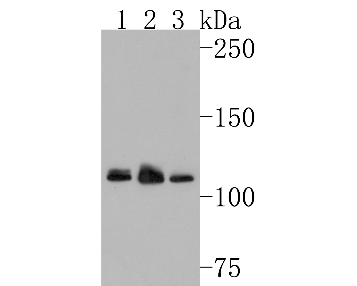 Western blot analysis of RNF111 on different lysates. Proteins were transferred to a PVDF membrane and blocked with 5% NFDM/TBST for 1 hour at room temperature. The primary antibody (HA500485, 1/500) was used in 5% NFDM/TBST at room temperature for 2 hours. Goat Anti-Rabbit IgG - HRP Secondary Antibody (HA1001) at 1:200,000 dilution was used for 1 hour at room temperature.<br />
Positive control: <br />
Lane 1: K562 cell lysate<br />
Lane 2: 293T cell lysate<br />
Lane 3: Hela cell lysate
