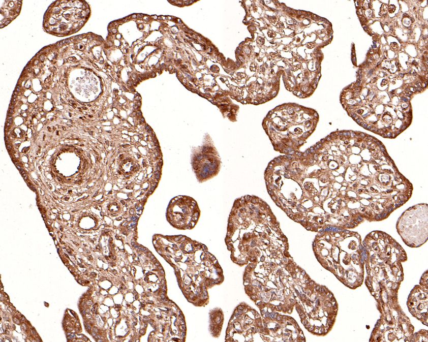 Immunohistochemical analysis of paraffin-embedded human placenta tissue using anti-RNF111 antibody. The section was pre-treated using heat mediated antigen retrieval with Tris-EDTA buffer (pH 9.0) for 20 minutes.The tissues were blocked in 1% BSA for 30 minutes at room temperature, washed with ddH2O and PBS, and then probed with the primary antibody (HA500485, 1/100) for 30 minutes at room temperature. The detection was performed using an HRP conjugated compact polymer system. DAB was used as the chromogen. Tissues were counterstained with hematoxylin and mounted with DPX.