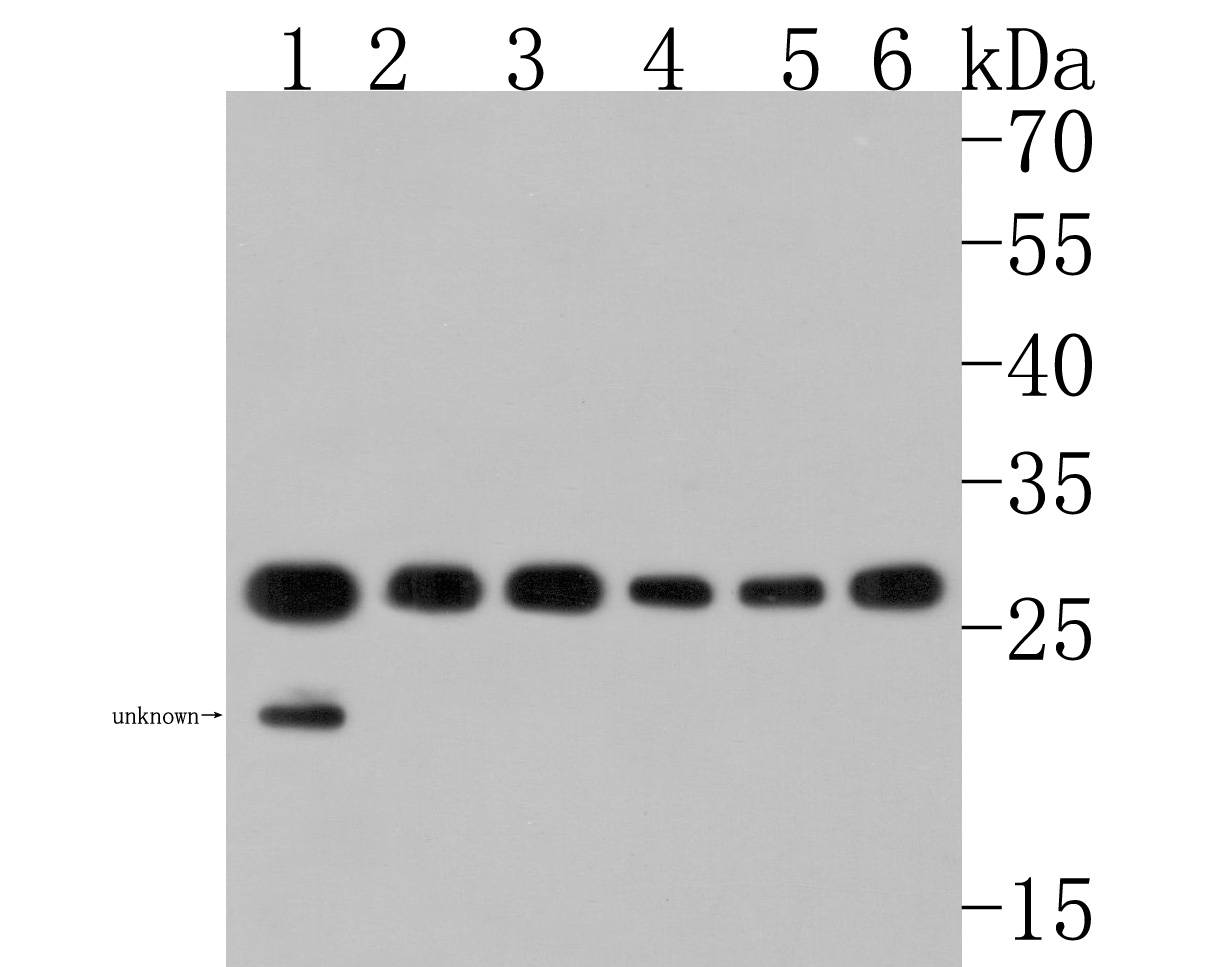 Western blot analysis of CacyBP on different lysates. Proteins were transferred to a PVDF membrane and blocked with 5% NFDM/TBST for 1 hour at room temperature. The primary antibody (HA500484, 1/1,000) was used in 5% NFDM/TBST at room temperature for 2 hours. Goat Anti-Rabbit IgG - HRP Secondary Antibody (HA1001) at 1:200,000 dilution was used for 1 hour at room temperature.<br />
Positive control: <br />
Lane 1: HepG2 cell lysate<br />
Lane 2: Jurkat cell lysate<br />
Lane 3: 293T cell lysate<br />
Lane 4: Mouse brain tissue lysate<br />
Lane 5: Rat spleen tissue lysate<br />
Lane 6: Mouse colon tissue lysate