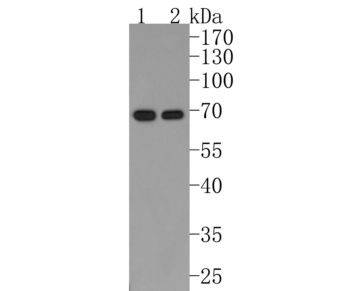 Western blot analysis of RAD52 on different lysates. Proteins were transferred to a PVDF membrane and blocked with 5% NFDM/TBST for 1 hour at room temperature. The primary antibody (HA500483, 1/500) was used in 5% NFDM/TBST at room temperature for 2 hours. Goat Anti-Rabbit IgG - HRP Secondary Antibody (HA1001) at 1:200,000 dilution was used for 1 hour at room temperature.<br />
Positive control: <br />
Lane 1: Hela cell lysate<br />
Lane 2: HL-60 cell lysate<br />
<br />
Predicted band size: 46 kDa<br />
Observed band size: 65 kDa