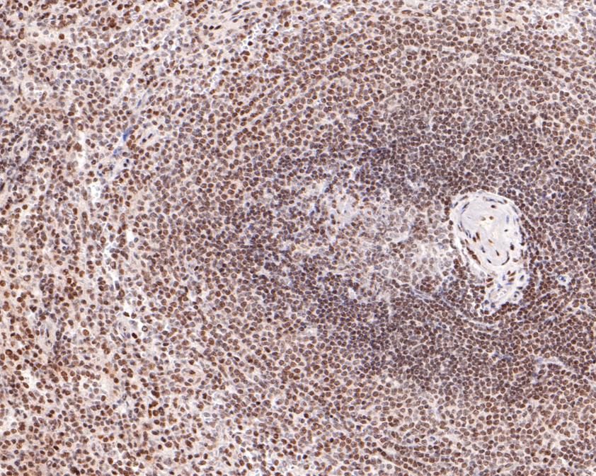 Immunohistochemical analysis of paraffin-embedded human spleen tissue using anti-RAD52 antibody. The section was pre-treated using heat mediated antigen retrieval with sodium citrate buffer (pH 6.0) for 20 minutes. The tissues were blocked in 1% BSA for 30 minutes at room temperature, washed with ddH2O and PBS, and then probed with the primary antibody (HA500483, 1/600)  for 30 minutes at room temperature. The detection was performed using an HRP conjugated compact polymer system. DAB was used as the chromogen. Tissues were counterstained with hematoxylin and mounted with DPX.