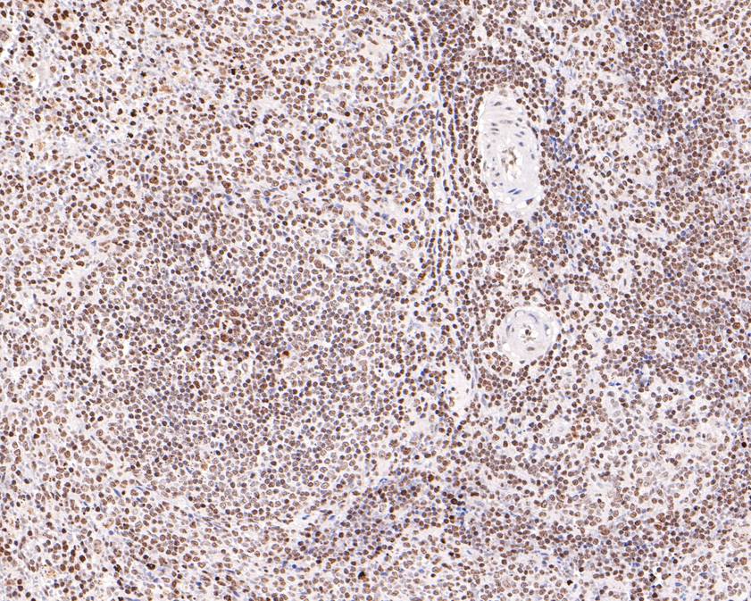 Immunohistochemical analysis of paraffin-embedded rat spleen tissue using anti-RAD52 antibody. The section was pre-treated using heat mediated antigen retrieval with sodium citrate buffer (pH 6.0) for 20 minutes. The tissues were blocked in 1% BSA for 30 minutes at room temperature, washed with ddH2O and PBS, and then probed with the primary antibody (HA500483, 1/600)  for 30 minutes at room temperature. The detection was performed using an HRP conjugated compact polymer system. DAB was used as the chromogen. Tissues were counterstained with hematoxylin and mounted with DPX.